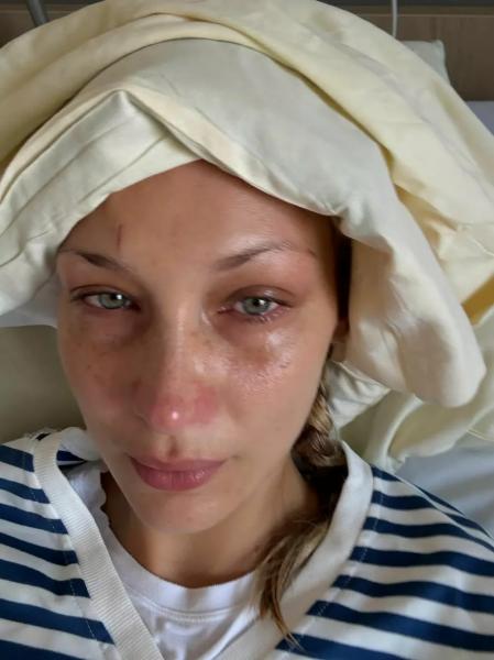 Мать Беллы Хадид трогательно поддержала дочь на фоне болезни
Мать Беллы Хадид трогательно поддержала дочь на фоне болезни