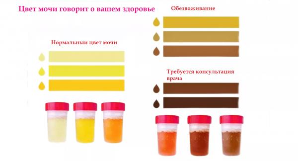О чем может говорить цвет мочи: понятная памятка (фото) О чем может говорить цвет мочи: понятная памятка (фото)