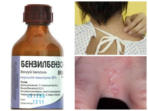 Как бороться с чесоточным клещом и методы лечения